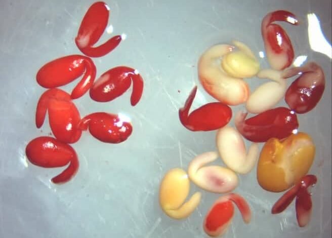 Nitro Blue Tetrazolium New Updates in Clinical Testing 2026