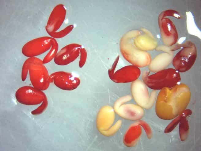 Nitro Blue Tetrazolium New Updates in Clinical Testing 2026