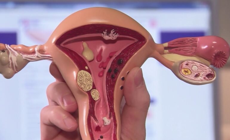 Pregnancy Risks with Bulky Uterus